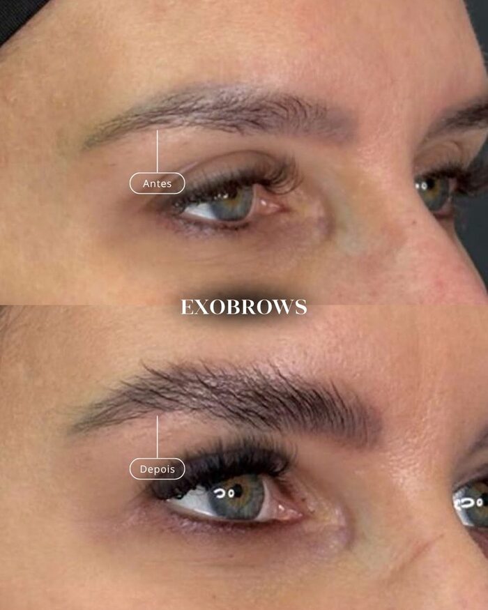Antes e depois de sobrancelha